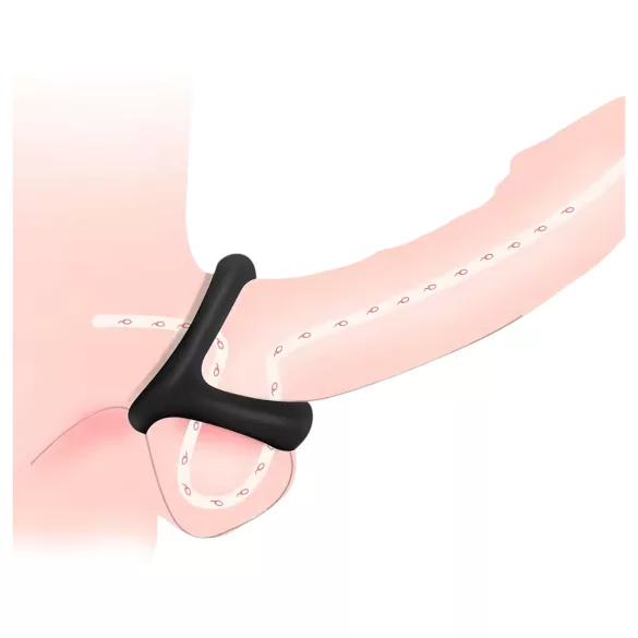 Anello per pene e scroto - superficie puntinata - silicone nero